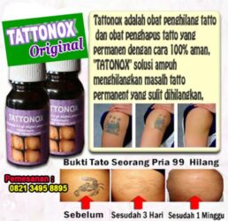 Obat Penghilang Tatto Tattonox